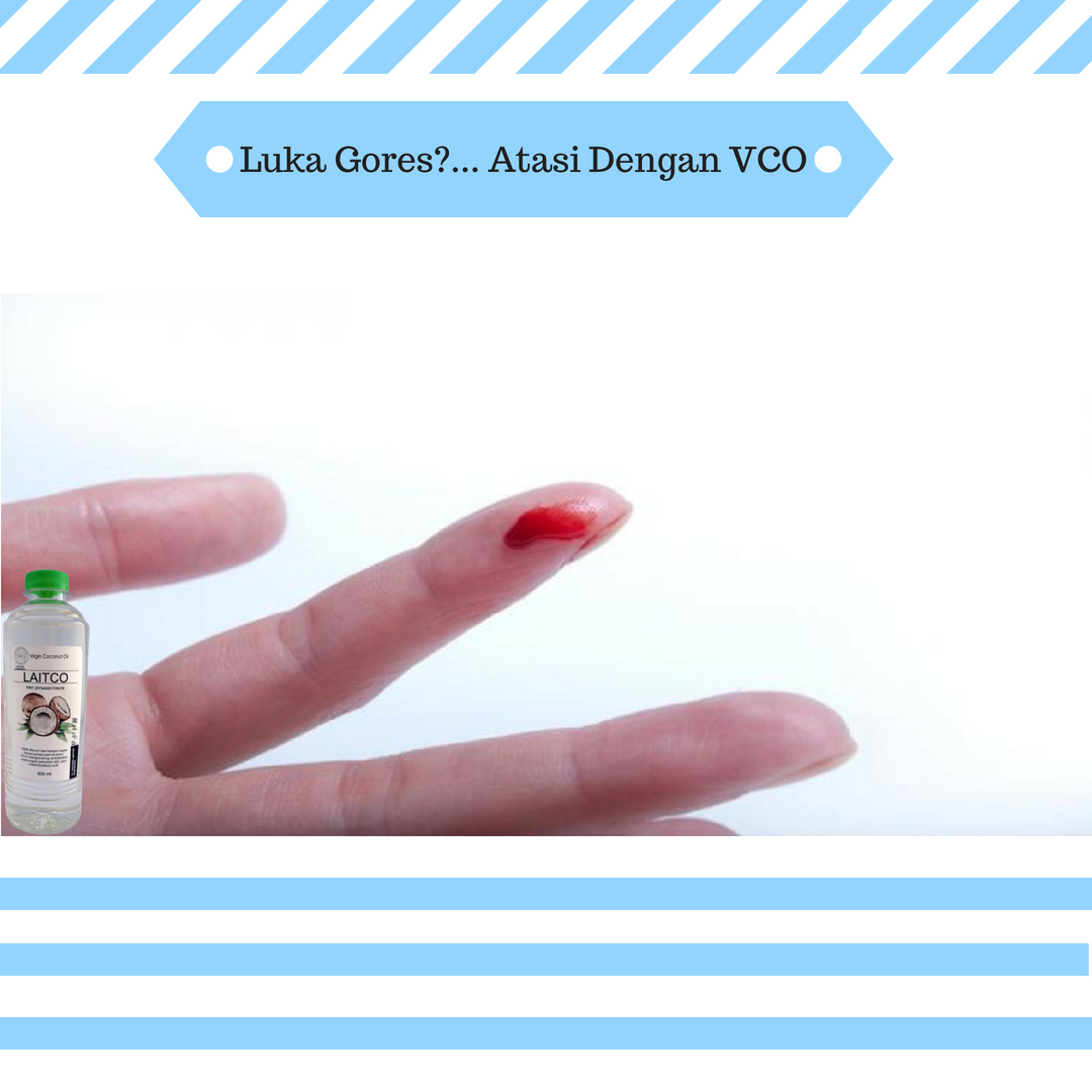 VCO Obat Luka Gores