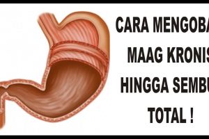 Terapi Yang Mendukung Kesembuhan Maag
