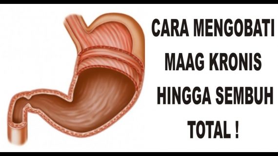Terapi Yang Mendukung Kesembuhan Maag
