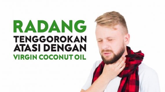 MENGATASI RADANG TENGGOROKAN DENGAN VCO