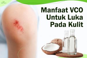 Manfaat VCO untuk Luka Pada Kulit