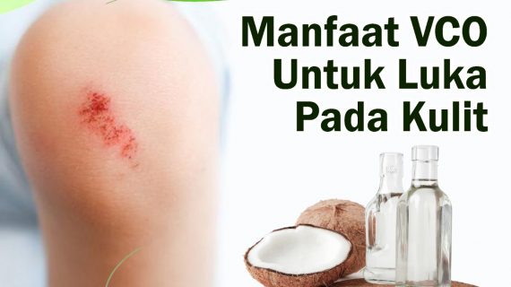 Manfaat VCO untuk Luka Pada Kulit