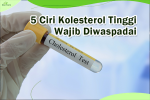 ciri-ciri kolesterol tinggi
