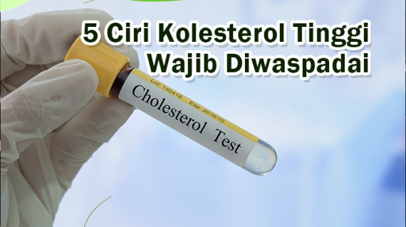 Ciri-Ciri Kolesterol Tinggi, Jangan Dibiarkan Begitu Saja