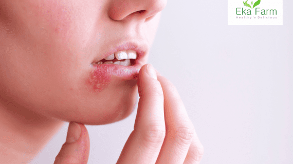 Herpes – Gejala Penyebab dan Cara mengobatinya