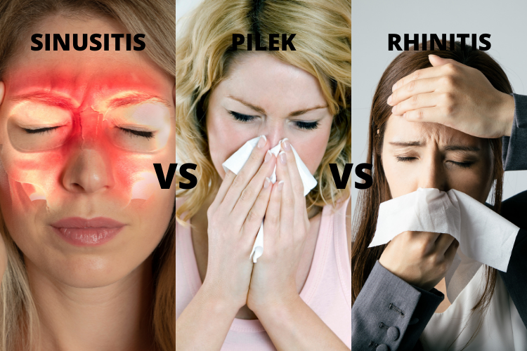 Sinusitis - Gejala Penyebab Dan Cara Mengobatinya – Eka Farm