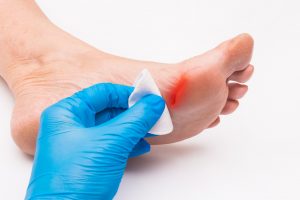 Komplikasi Diabetes Melitus Tipe 2 dan Cara Mencegahnya