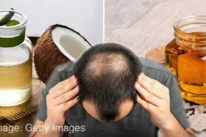 Temukan Rahasia Alami Manfaat Minyak Kelapa untuk Rambut Disini