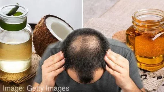 Temukan Rahasia Alami Manfaat Minyak Kelapa untuk Rambut Disini