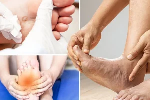 Tanda Kolesterol Tinggi yang Sering Terabaikan dan Cara Mengatasinya